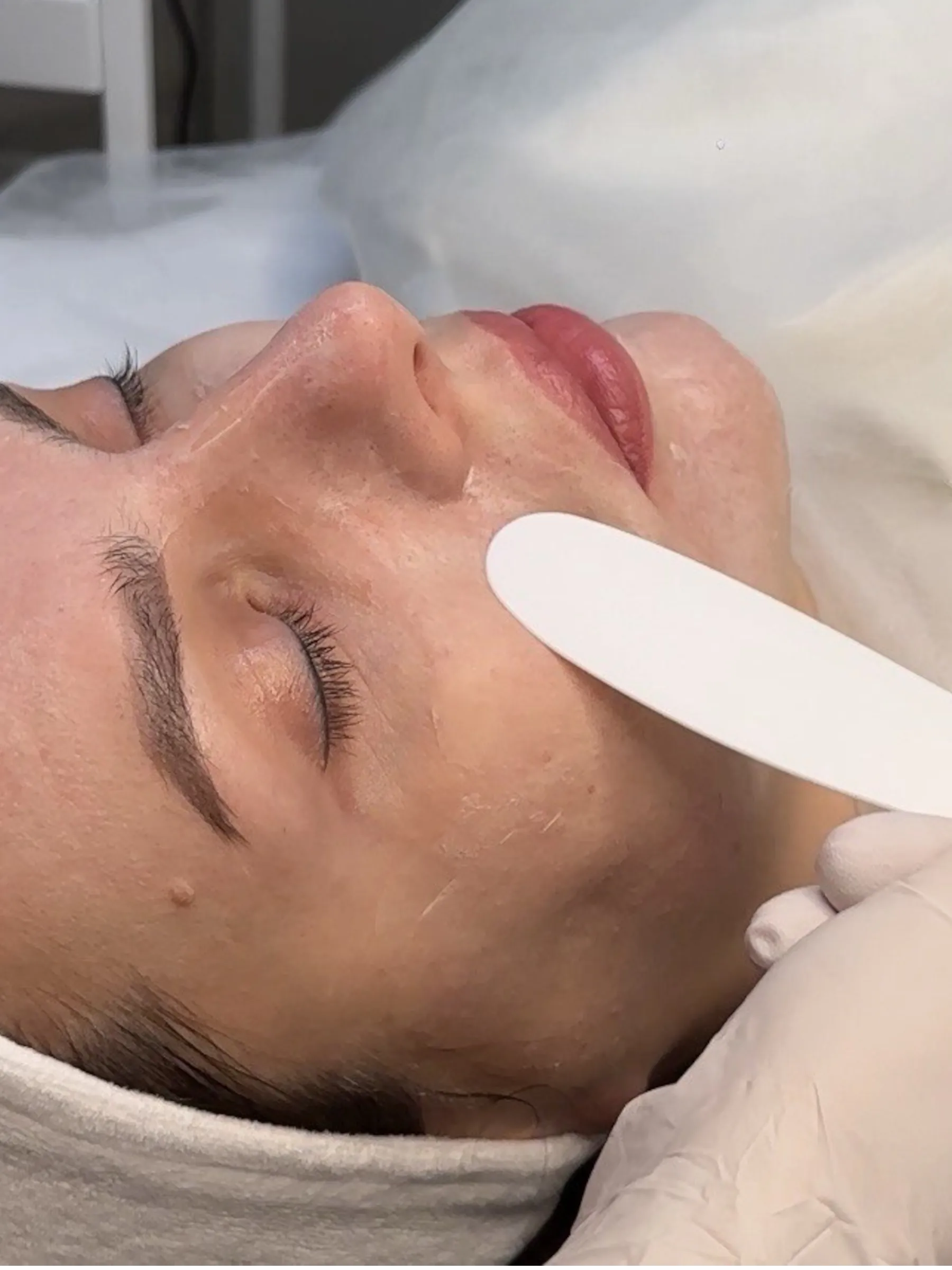 JUVENA — регенерація